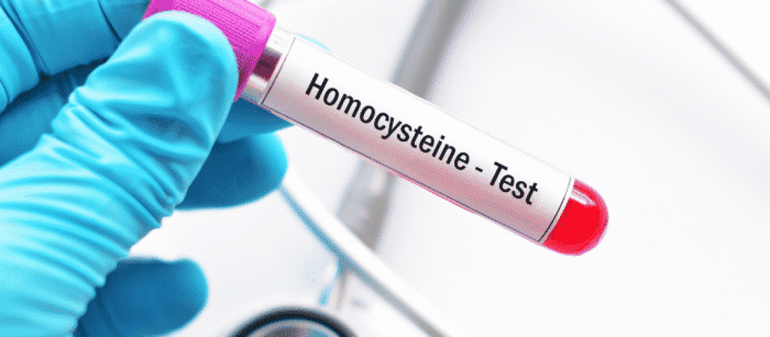 Homocysteine: The One Health Marker That is Critical for Optimal Health